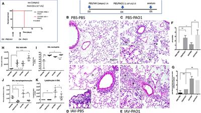 Influenza A Virus Pre-Infection Exacerbates Pseudomonas aeruginosa-Mediated Lung Damage Through Increased MMP-9 Expression, Decreased Elafin Production and Tissue Resilience